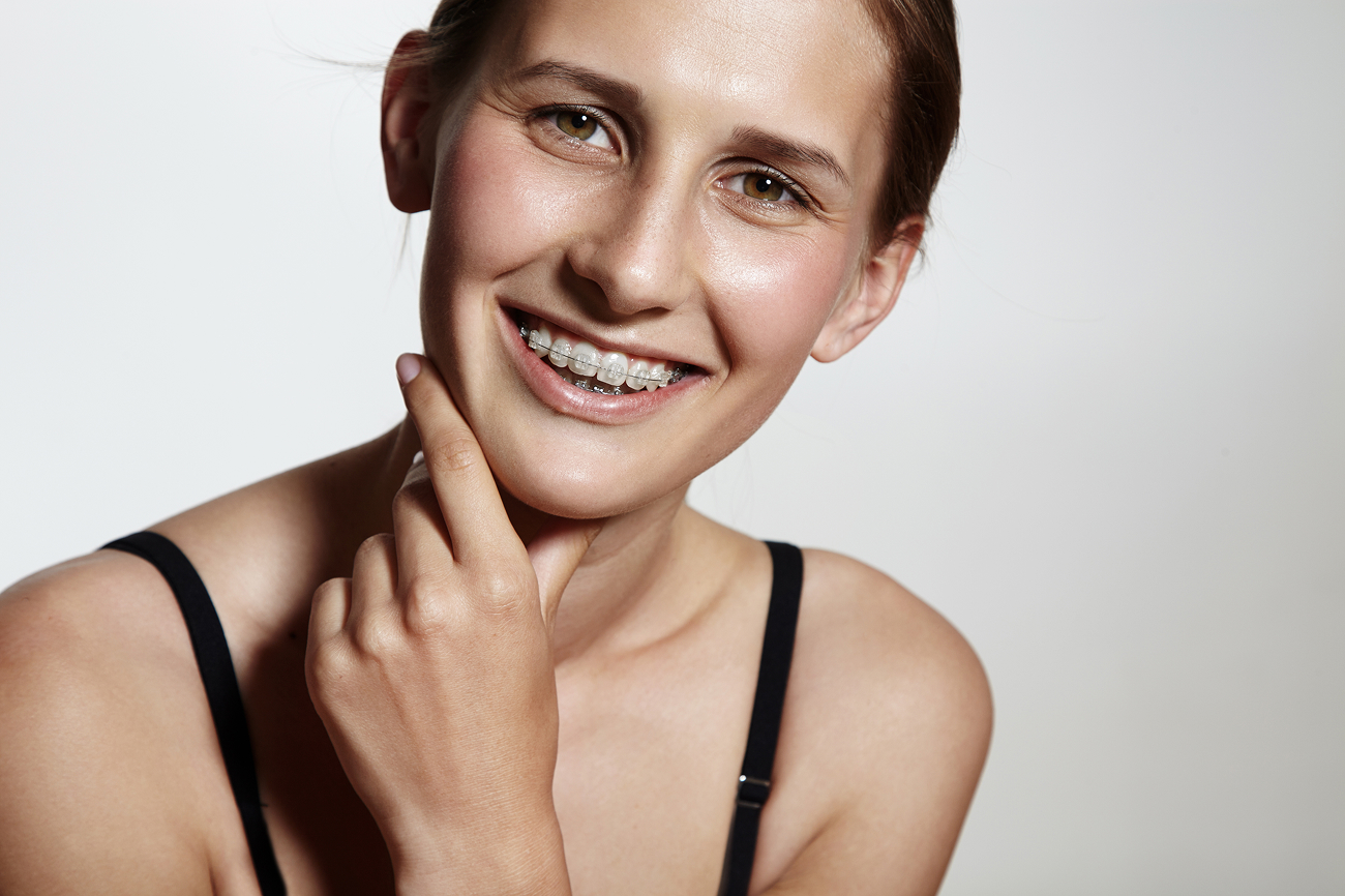Clear Ceramic Braces